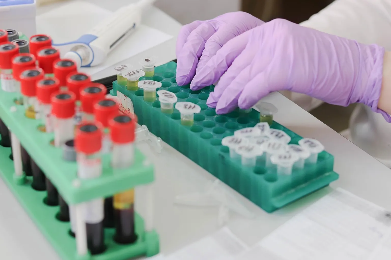 Epigenetische Tests ersetzen subjektive Angaben zu Tabak- und Alkoholkonsum in Studien